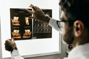 Dentist looking at teeth x-rays