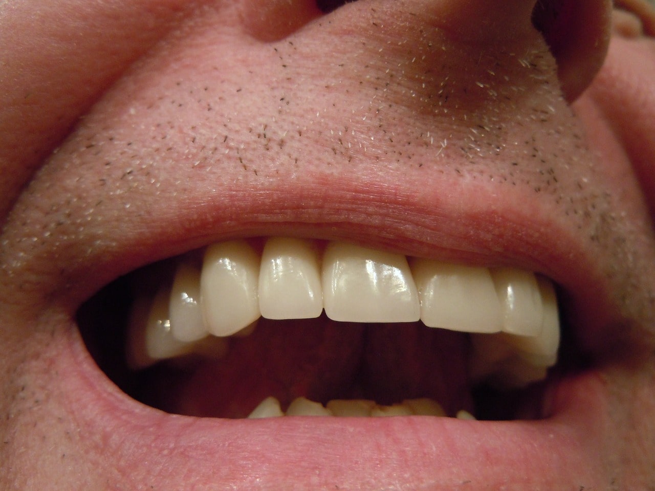 close up of a mans teeth