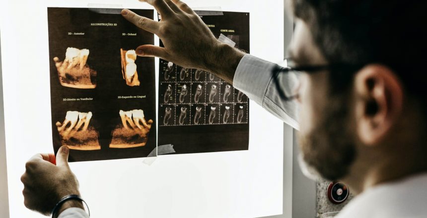 Dentist looking at teeth x-rays