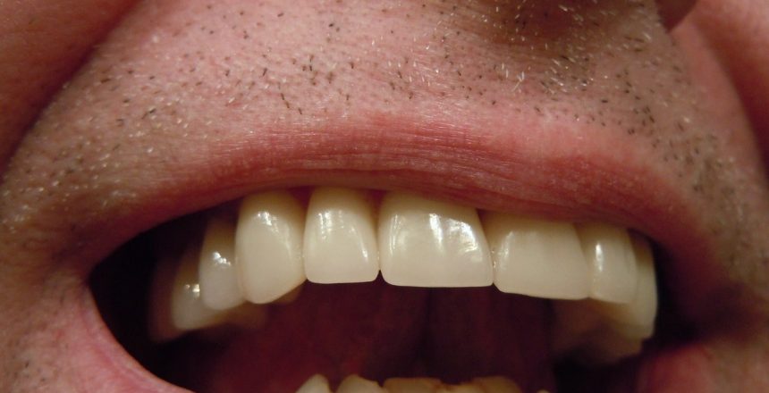 close up of a mans teeth