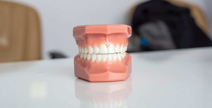 model of teeth