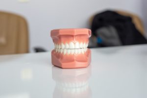 model of teeth