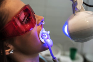 Benefits of Teeth Whitening - Robert B. Guttry, DDS - Dentist in Longview, TX